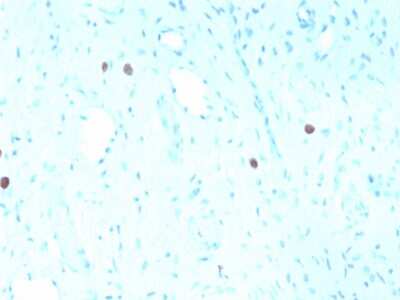 Immunohistochemistry-Paraffin: HPV16 Antibody (rHPV16L1/1058) - Azide and BSA Free [NBP3-08318]