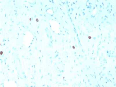 Immunohistochemistry-Paraffin: HPV16 Antibody (rHPV16L1/1058) [NBP3-07259]