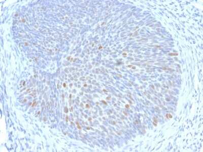 Immunohistochemistry-Paraffin: HPV16 E1+E4 Antibody (HPV16 E1/E4) - Azide and BSA Free [NBP3-08319]