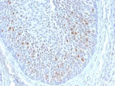 Immunohistochemistry-Paraffin: HPV16 E1+E4 Antibody (HPV16 E1/E4) [NBP3-07260]
