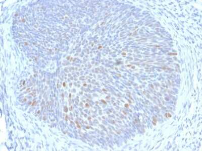 Immunohistochemistry-Paraffin: HPV16 E1+E4 Antibody (HPV16 E1/E4) [NBP3-07260]