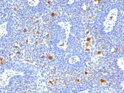 Immunohistochemistry-Paraffin: HPV16 Antibody (HPV16/1296) - Azide and BSA Free [NBP2-54510]