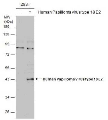 Western Blot: HPV18 E2 Antibody [NBP3-13219]