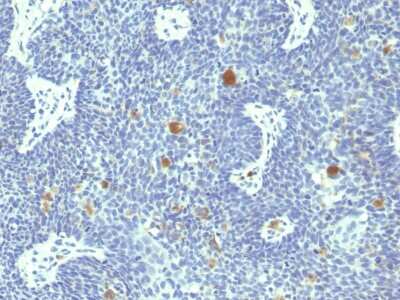 Immunohistochemistry-Paraffin: HPV18 E6 Antibody (HPV18/1297) - Azide and BSA Free [NBP3-08845]