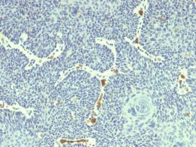 Immunohistochemistry-Paraffin: HPV18 E6 Antibody (HPV18/1297) - Azide and BSA Free [NBP3-08845]