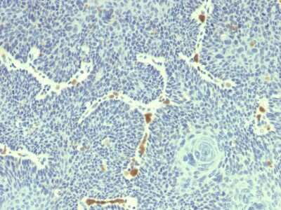 Immunohistochemistry-Paraffin: HPV18 E6 Antibody (HPV18/1297) [NBP3-07521]
