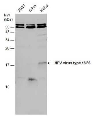 Western Blot: HPV18 E6 Antibody [NBP3-13129]