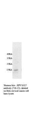 Western Blot: HPV18 E7 Antibody (718-15) [NB110-17215]