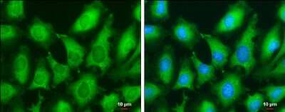 Immunocytochemistry/ Immunofluorescence: HPV18 E7 Antibody (GT881) [NBP3-13610]
