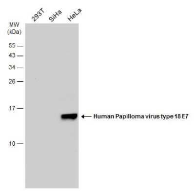 Western Blot: HPV18 E7 Antibody (GT881) [NBP3-13610]