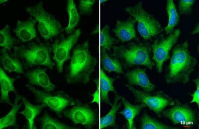 Immunocytochemistry/ Immunofluorescence: HPV18 E7 Antibody [NBP3-13223]