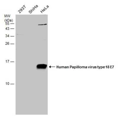 Western Blot: HPV18 E7 Antibody [NBP3-13223]
