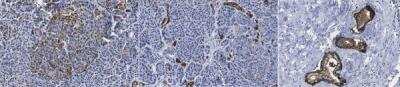 Immunohistochemistry-Paraffin: HPa3 Antibody (HIC3-2D12) [NBP3-18520]
