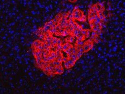 Immunocytochemistry/ Immunofluorescence: HPi2 Antibody (HIC1-2B4.2B) [NBP1-18946]