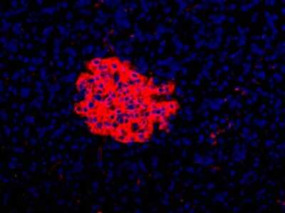 Immunocytochemistry/ Immunofluorescence: HPi3 Antibody (HIC1-7H10) [NBP1-18947]