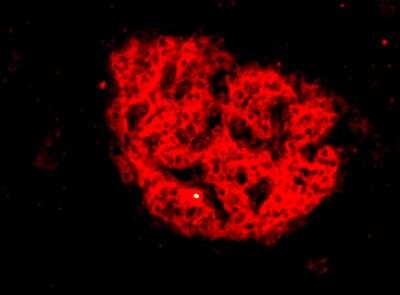 Immunocytochemistry/ Immunofluorescence: HPi4 Antibody (HIC1-5F10) [NBP1-18948]