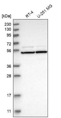 Western Blot: HR23A/Rad23A TUBE1 Antibody [NBP2-68598]