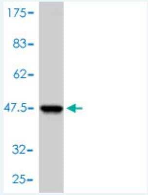 Western Blot: HR6A/UBE2A Antibody (3D7-E2) [H00007319-M01]