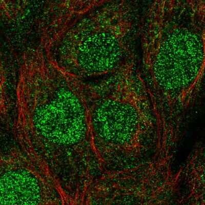 Immunocytochemistry/ Immunofluorescence: HR6A/UBE2A Antibody [NBP2-57290]