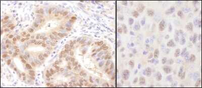 Immunohistochemistry-Paraffin: HR6A/UBE2A Antibody [NB100-553]