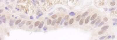 Immunohistochemistry: HR6A/UBE2A Antibody [NB100-554]