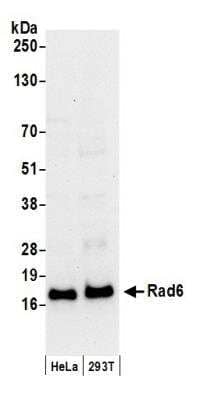 Western Blot: HR6A/UBE2A Antibody [NB100-553]