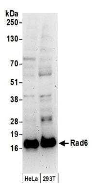 Western Blot: HR6A/UBE2A Antibody [NB100-554]