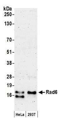 Western Blot: HR6A/UBE2A Antibody [NB100-555]