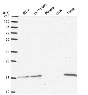 Western Blot: HR6A/UBE2A Antibody [NBP2-54946]