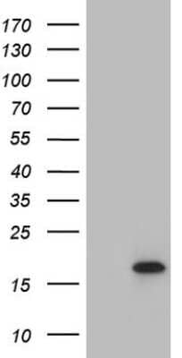 Western Blot: HR6B/UBE2B Antibody (OTI1E11) [NBP2-46262]