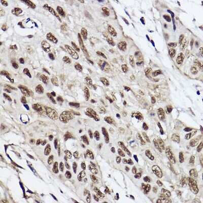 Immunohistochemistry-Paraffin: HR6B/UBE2B Antibody (2Z3R2) [NBP3-15271]