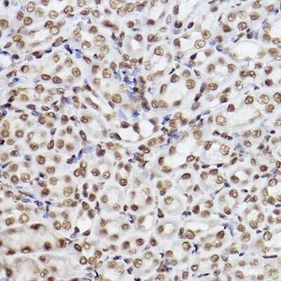 Immunohistochemistry-Paraffin: HR6B/UBE2B Antibody (2Z3R2) [NBP3-15271]
