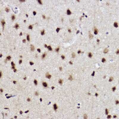 Immunohistochemistry-Paraffin: HR6B/UBE2B Antibody (2Z3R2) [NBP3-15271]