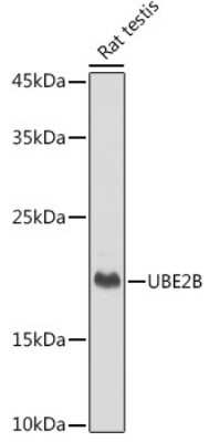 Western Blot: HR6B/UBE2B Antibody (2Z3R2) [NBP3-15271]