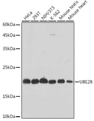 Western Blot: HR6B/UBE2B Antibody (2Z3R2) [NBP3-15271]