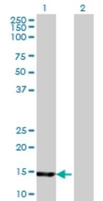 Western Blot: HR6B/UBE2B Antibody (4C3) [H00007320-M06]