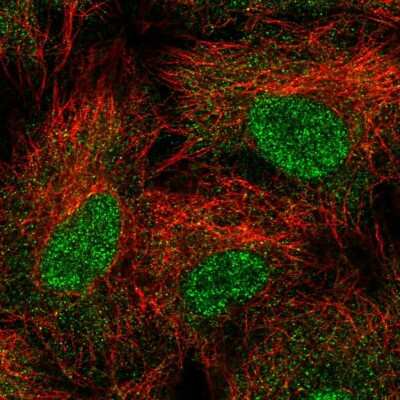 Immunocytochemistry/ Immunofluorescence: HR6B/UBE2B Antibody [NBP2-58772]