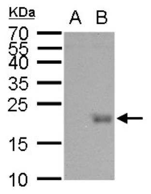 Western Blot: HR6B/UBE2B Antibody [NBP1-31293]