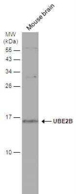 Western Blot: HR6B/UBE2B Antibody [NBP1-31293]