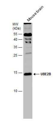 Western Blot: HR6B/UBE2B Antibody [NBP2-20781]