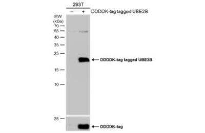 Western Blot: HR6B/UBE2B Antibody [NBP2-20781]