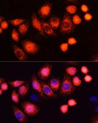 Immunocytochemistry/ Immunofluorescence: HRAS Antibody - Azide and BSA Free [NBP3-04486]