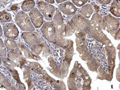 Immunohistochemistry-Paraffin: HRAS Antibody [NBP2-42864]