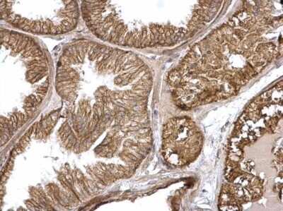 Immunohistochemistry-Paraffin: HRAS Antibody [NBP2-42864]