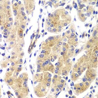 Immunohistochemistry-Paraffin: HRAS Antibody - BSA Free [NBP3-04117]