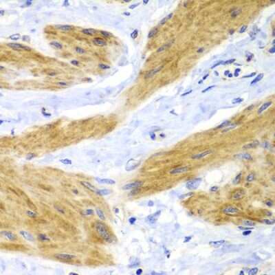 Immunohistochemistry-Paraffin: HRAS Antibody - BSA Free [NBP3-04117]