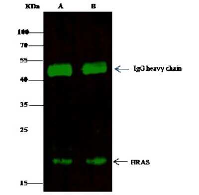 Immunoprecipitation: HRAS Antibody [NBP2-99921]