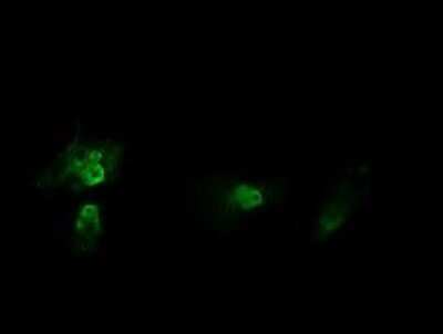 Immunocytochemistry/ Immunofluorescence: HRAS Antibody (OTI1D9) - Azide and BSA Free [NBP2-74847]