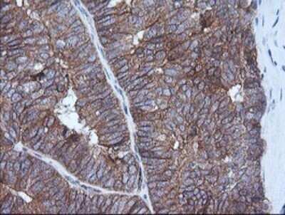 Immunohistochemistry: HRAS Antibody (OTI1D9) - Azide and BSA Free [NBP2-74847]