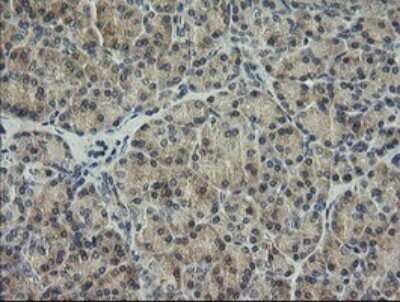 Immunohistochemistry: HRAS Antibody (OTI1D9) - Azide and BSA Free [NBP2-74847]